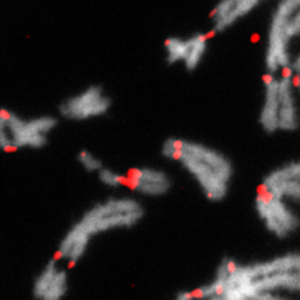 Les chromosomes (en gris) avec des cassures au niveau des centromères (en rouge) suite à des altérations des dynamiques de réplication de l’ADN.