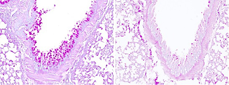 Production de mucus dans le poumon après inhalation d'un allergène (coupes de poumon, coloration du mucus en rose magenta).