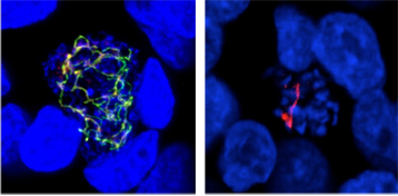 Parasite de la malaria à l'intérieur de cellules de foie humaines.