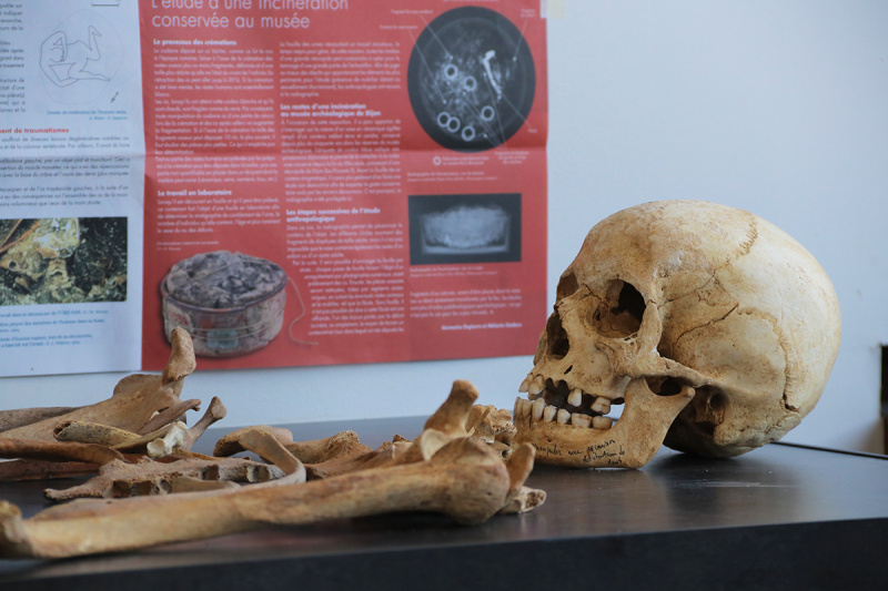 Des squelettes humains au laboratoire Artehis