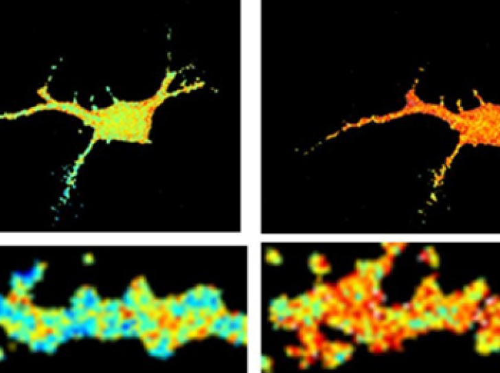 Alzheimer's disease : how amyloid aggregates alter neuronal function