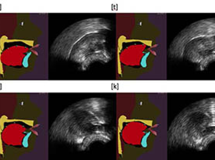 Augmented tongue ultrasound for speech therapy
