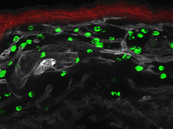 The search for the origin of mast cells